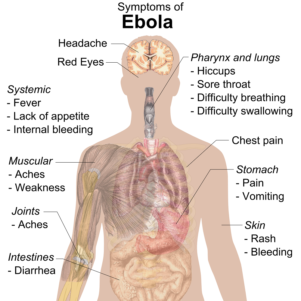 Symptoms of Ebola