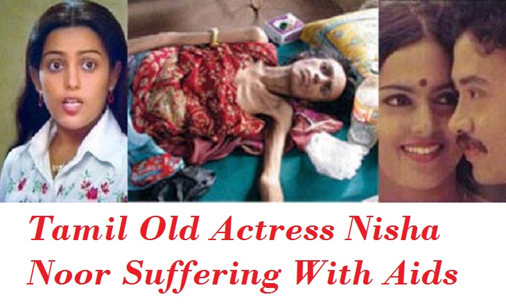 Tamil Old Actress Nisha Noor Suffering With Aids – HIV -