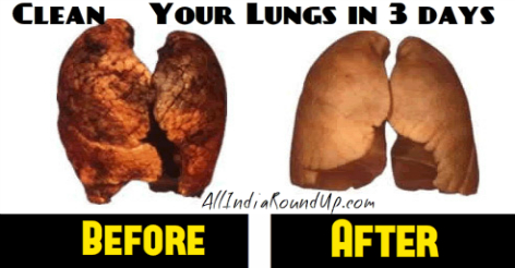 Before-and-After-Quitting-Smoking