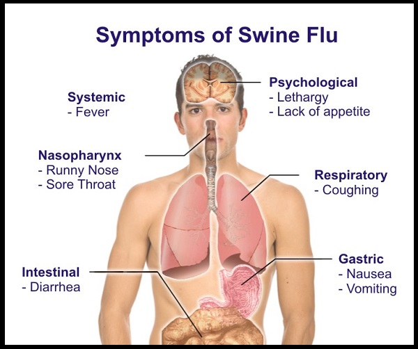 swineflu symptoms