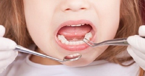 3 Year Old Girl Dies While Undergoing Root Canal In Pune