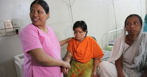Free Treatment for Acid Attack Victims