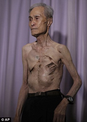 japanese atomic bomb survivors