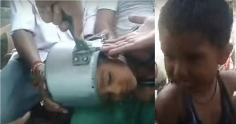 locals removing pressure cooker stuck in boy’s head 