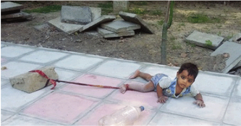 Toddler With Legs Had Been Tied To A Stone