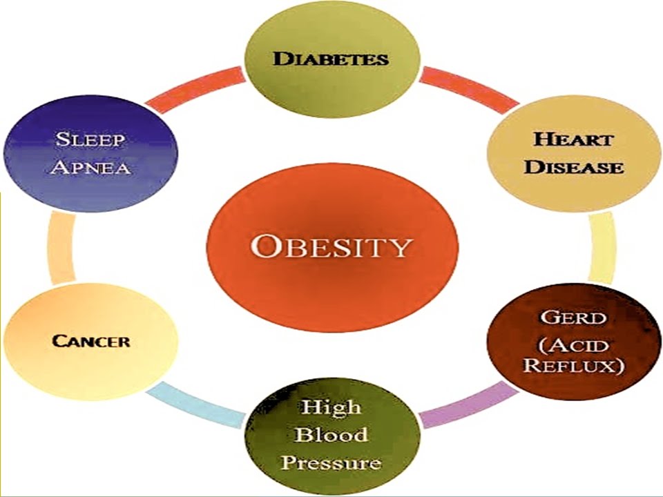 Illnesses with Obesity