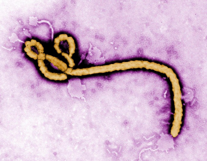 An Ebola virus