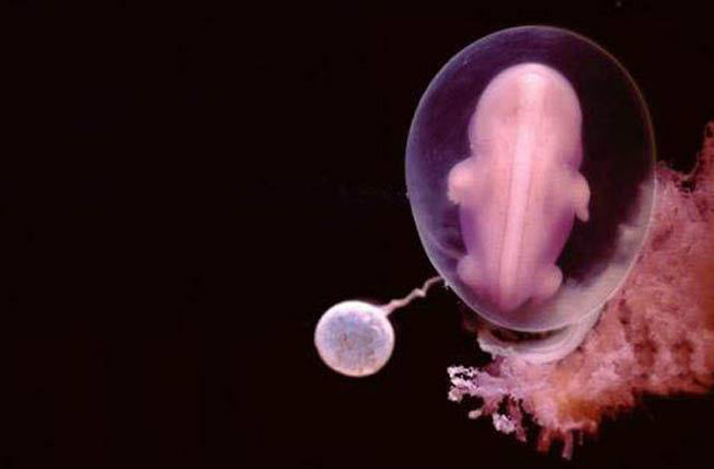 photos-of-foetus-developing-inside-a-womb10