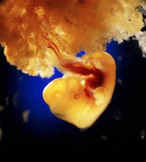 photos-of-foetus-developing-inside-a-womb12