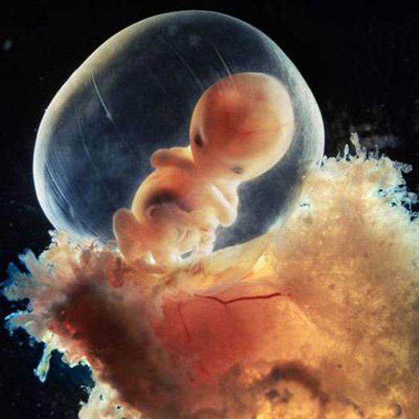 photos-of-foetus-developing-inside-a-womb14