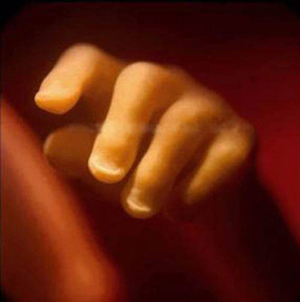 photos-of-foetus-developing-inside-a-womb18