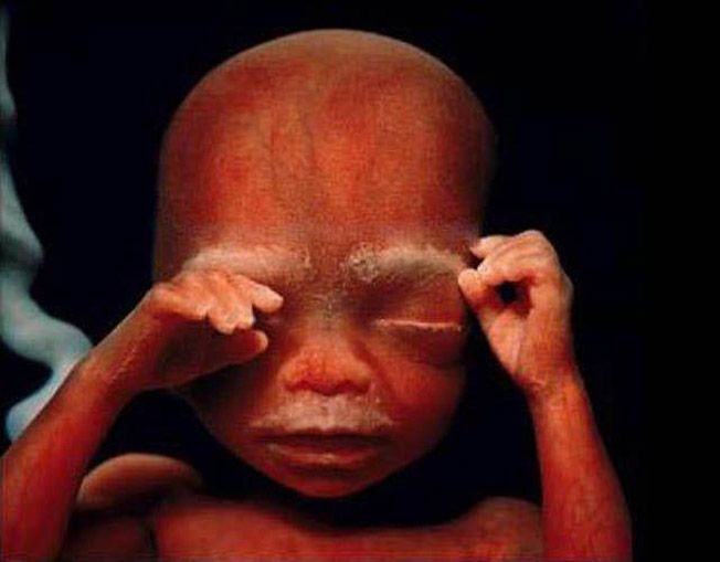 photos-of-foetus-developing-inside-a-womb22