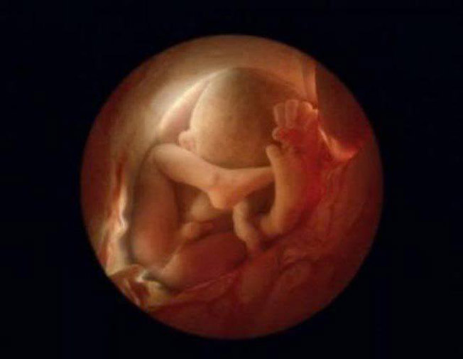 photos-of-foetus-developing-inside-a-womb23