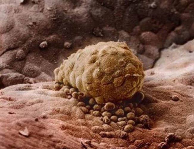 photos-of-foetus-developing-inside-a-womb7