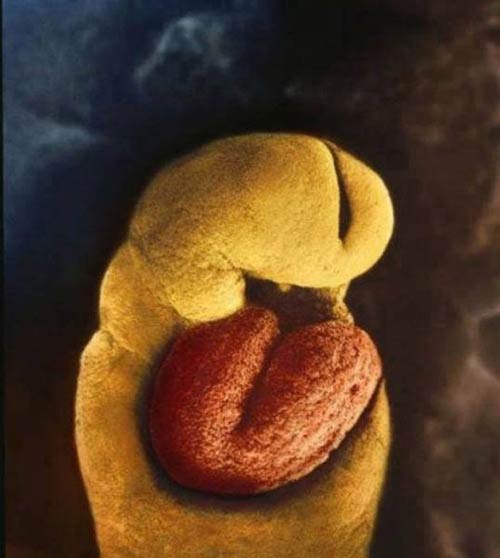 photos-of-foetus-developing-inside-a-womb9
