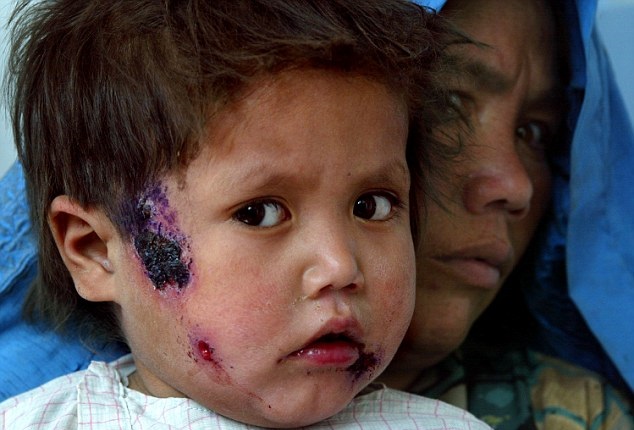 ISIS-Occupied Syria Is Being Attacked by a 'Flesh-Eating' Leishmaniasis