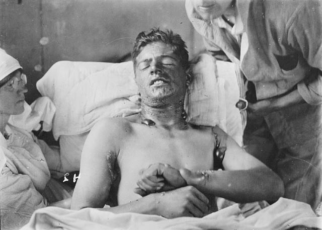 Mustard Gas Tested on American Military