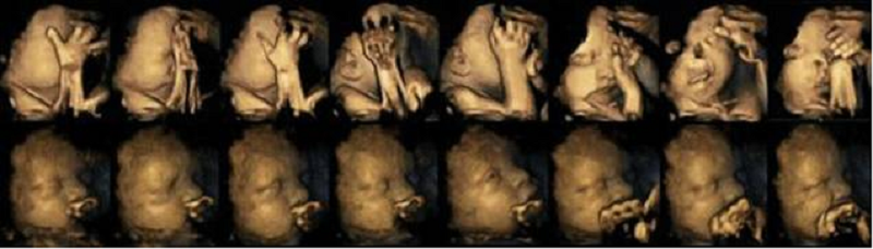 4D Ultrasound Scan Shows Effects Of Smoking On Babies During Pregnancy