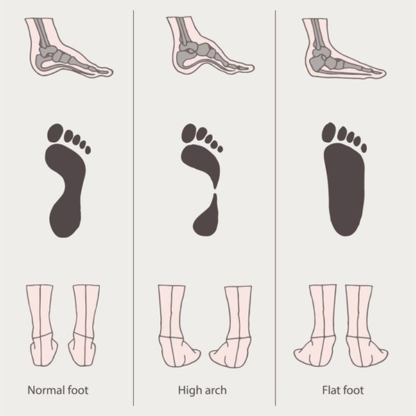 What Your Foot Tells About You (18)