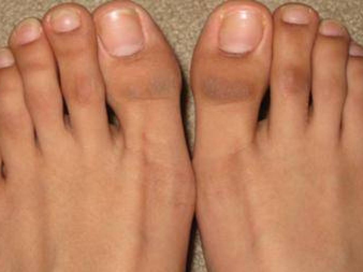 What Your Foot Tells About You (9)