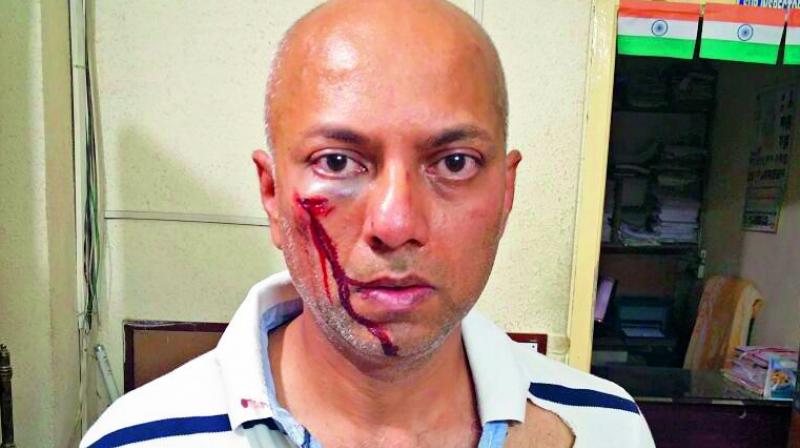 Telugu Music Director Shashi Preetam Attacked By Neighbour (1)