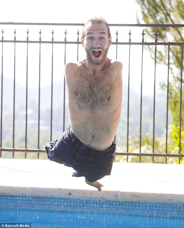 Nick Vujicic - An Inspiring Man Born With No Limbs (1)