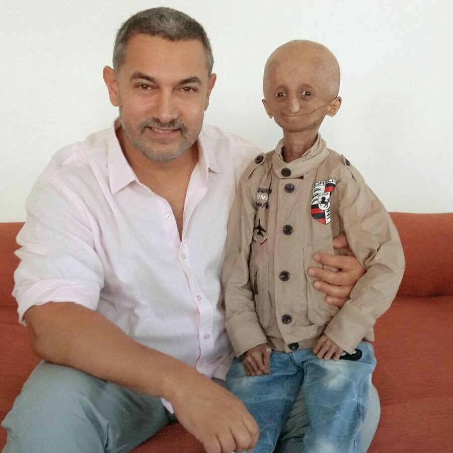 Nihal Bitla, Face Of 'Progeria' In India, Dies at 15 (5)