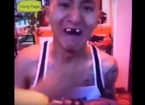 Man lost teeth trying to eat raw corn fixed to driller