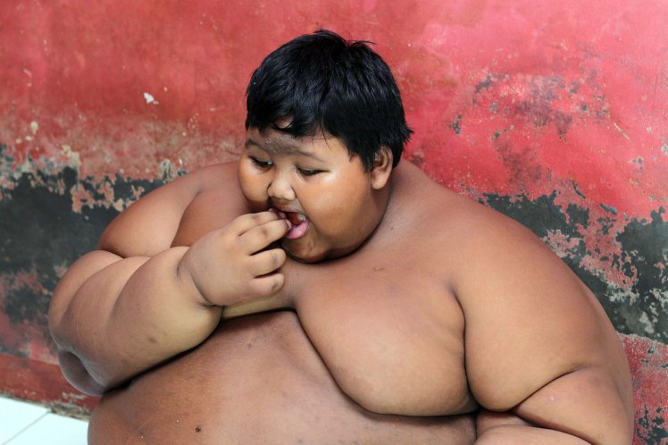 Arya Permana - Fattest Child In The World (1)