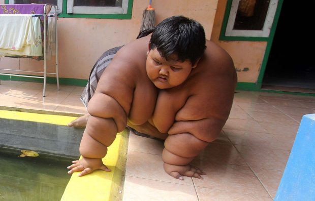 Arya Permana - Fattest Child In The World (3)