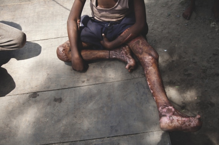 Victims of Jharia mining town