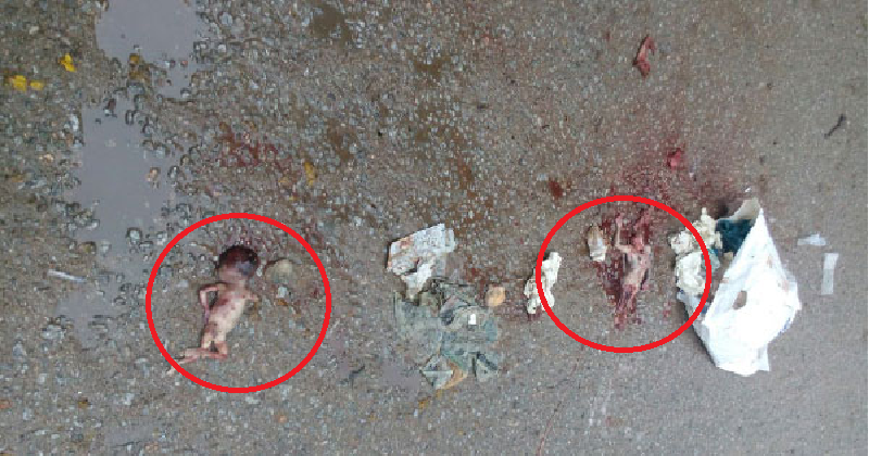 3 Dead Fetus Found On Road Near Nalgonda Police Station