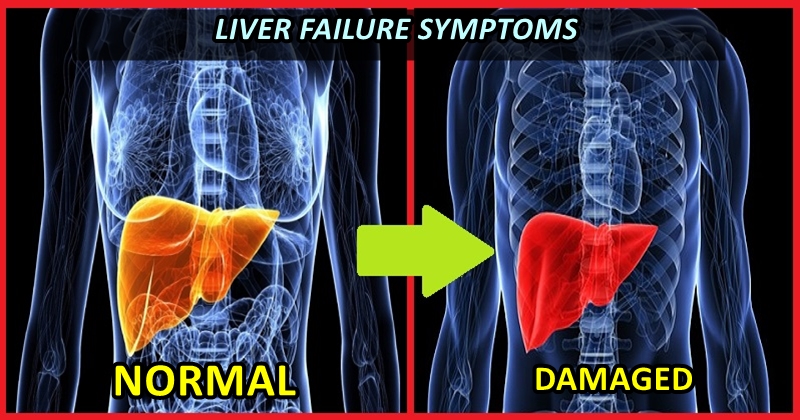 8 Times When You Fail To Notice The Symptoms That Indicate A Serious ...