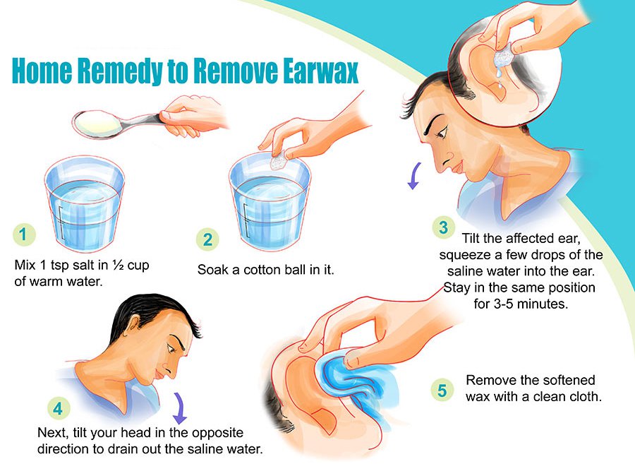 home-remedy-for-removing-earwax