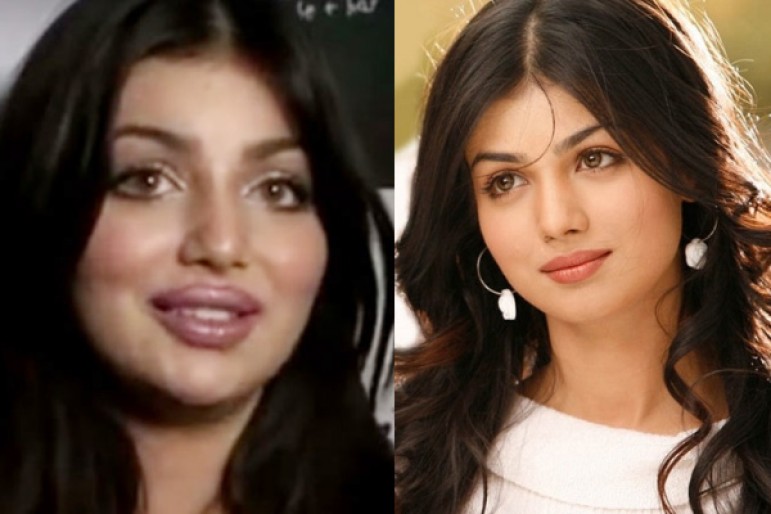 Ayesha Takia Now Hits Back The People Who Trolled Her About The Post Lip-Surgery Looks,,