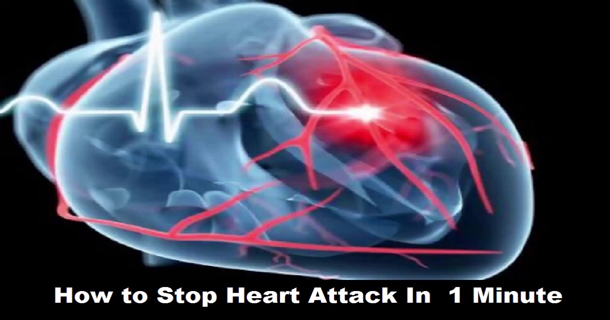 Learn How To Stop Heart Attack In Just 1 Minute