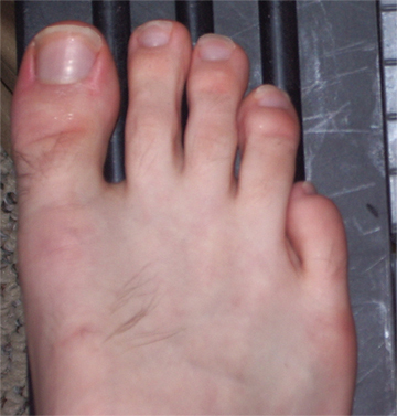 Is Your Second Toe Taller Than Other Toes? Find What It Says About Your ...