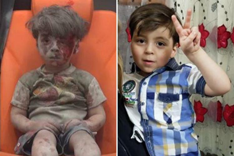 syrian kid viral pics Omran Daqneesh present pic