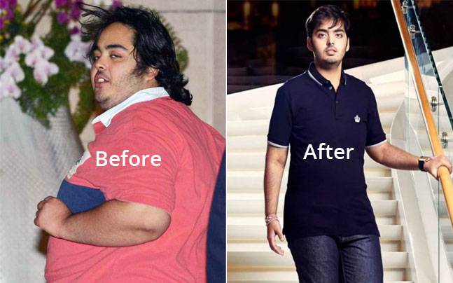 anant-ambani-before and after weight loss