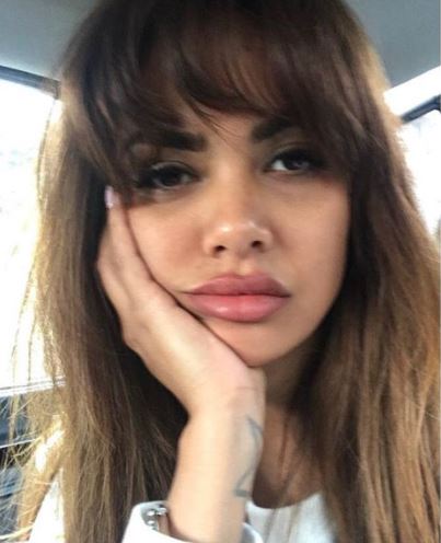 Instagram Bomb Esha Gupta Undergoes Extensive Lip-Surgery Which Only