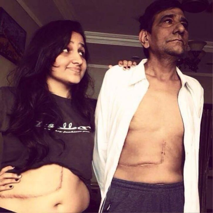 Daughter donates Liver to her father