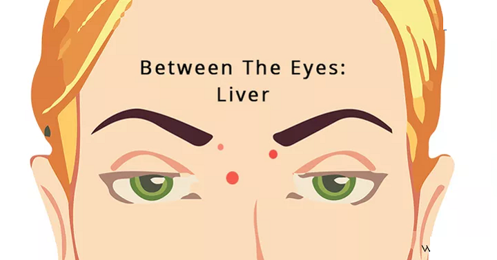 Between The Eyebrows-The Position Of Your Acne Reveals A lot About Your Health (2)