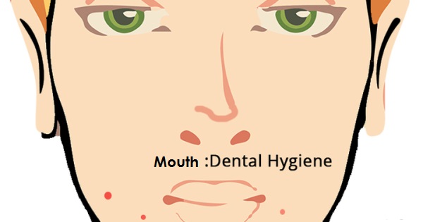 Mouth-The Position Of Your Acne Reveals A lot About Your Health (4)
