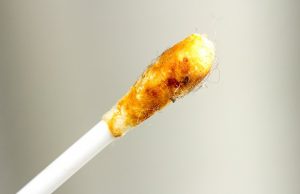 8 Things Your Earwax Could Reveal About Your Health (4)