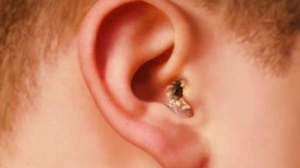 8 Things Your Earwax Could Reveal About Your Health (3)