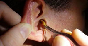 8 Things Your Earwax Could Reveal A Lot About Your Health ...