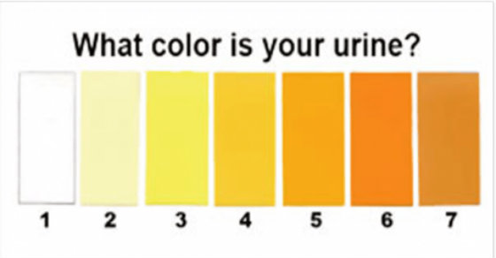 what-color-urine-means-health