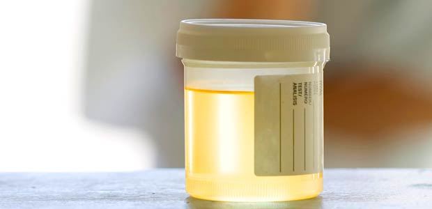 The Color Of Your Urine Reveals About Your Health Issues Must Know