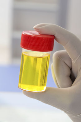 neon yellow urine color