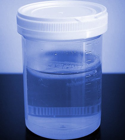 Blue urine